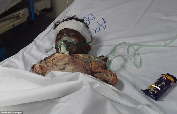 329B755C00000578-3511528-An_injured_Pakistani_child_victim_of_a_suicide_blast_rests_in_a_-a-7_1459151759239.jpg